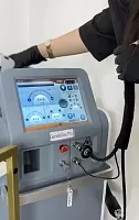 Александритовый лазер CANDELA GENTLEMAX PRO